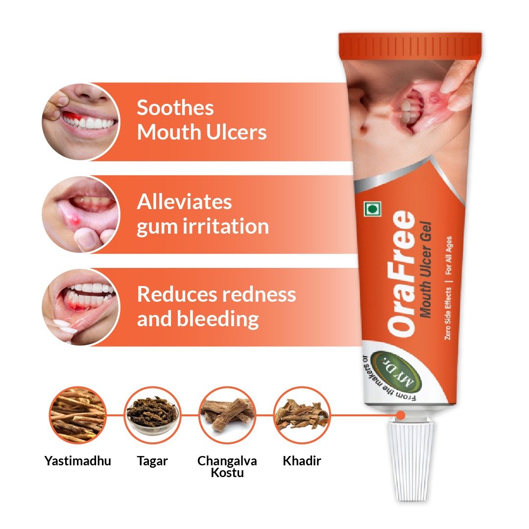 Orafree Ayurvedic Mouth Ulcer Gel – Fast Pain Relief for Canker Sores & Gum Inflammation | 10g | Pack of 3 (Hover)